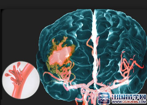 神经内科年终工作总结
